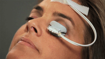 Image: The LipiFlow Thermal Pulsation System (Photo courtesy of TearScience).